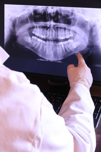 Best Emergency Treatment for Toothache in Palisade, CO